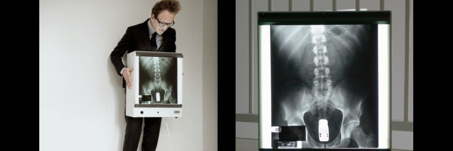 This is a Story About an X-ray of Ryan Dunn's Butt — LBB